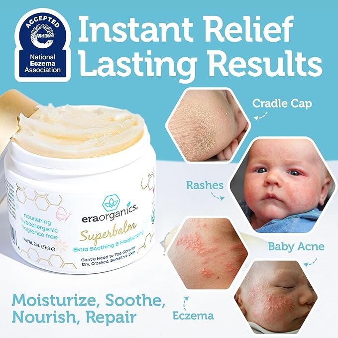 2 Era Organics Healing Ointment for Babies - USDA Certified Organic Natural Gentle Moisturizer for Sensitive Skin Prone To Baby Eczema, Cradle Cap (Infant Seborrheic Dermatitis), Rashes, Hives & More