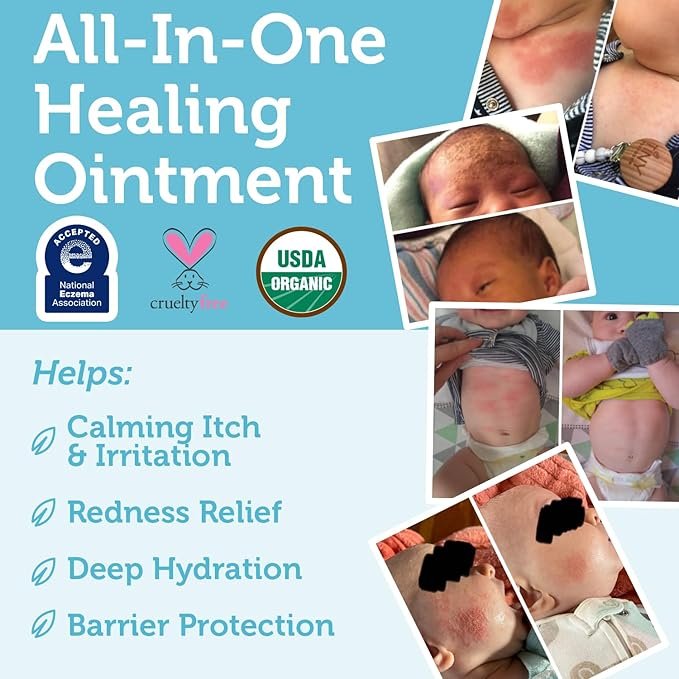 4 Era Organics Healing Ointment for Babies - USDA Certified Organic Natural Gentle Moisturizer for Sensitive Skin Prone To Baby Eczema, Cradle Cap (Infant Seborrheic Dermatitis), Rashes, Hives & More