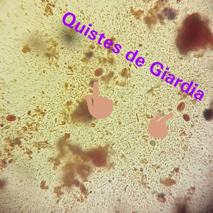 quistes de giardia en heces