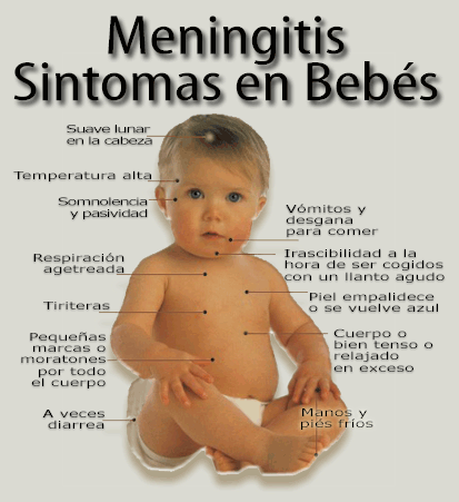 sintomas-de-la-meningitis.gif