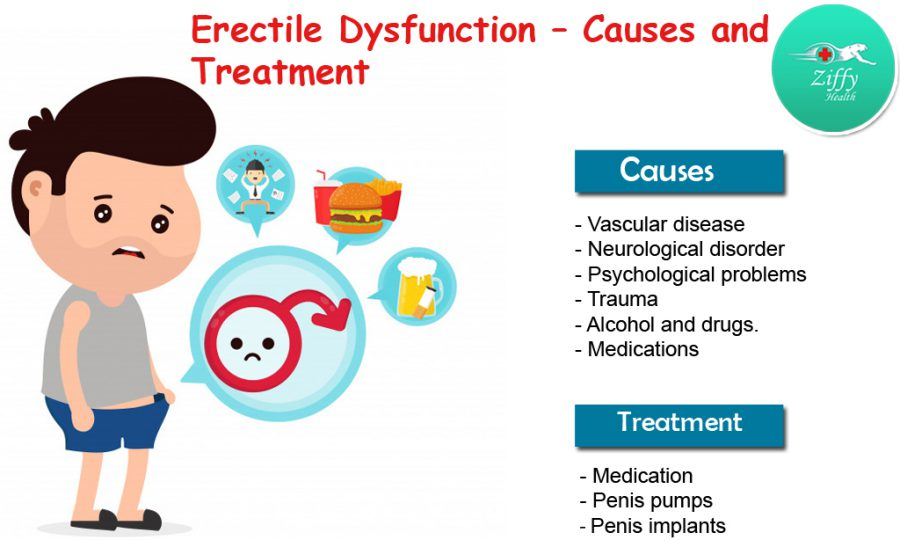 Impotence Erectile Dysfunction in Men Causes Symptoms and its