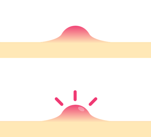 skin4617711__480.png
