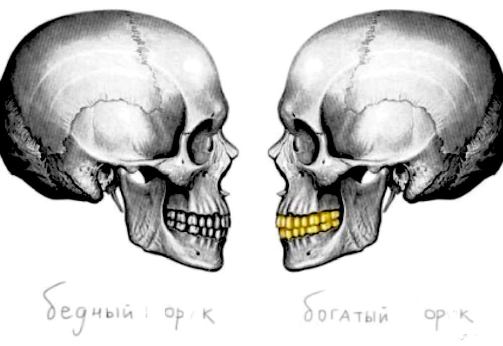 https://files.peakd.com/file/peakd-hive/motionup/242NzQ9mxUe2QKZG4QdtBhvKjqgjs46RJ6VSmiZcfQWvfDeeftkrc1Cz45UoRWhV77wi1.png