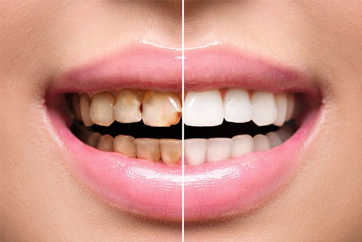https://images.ecency.com/DQmdXzDJ3egjqc7mjnVSksRMNN2eq1zp6JTdwxUcE4NKCLz/bristol_dental.jpg