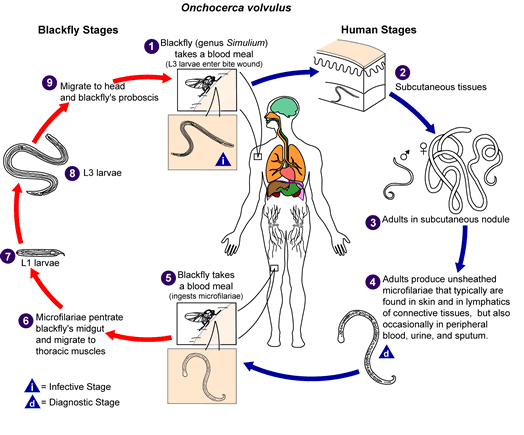 Onchocerca_volvulus_LifeCycle.gif