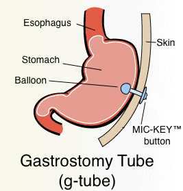 g-tube-cross-section.gif