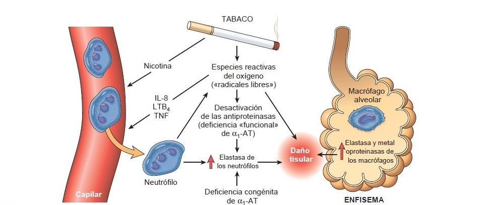 fisiopatología del enfisema