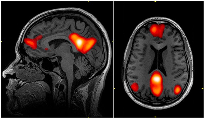 fMRI Signal