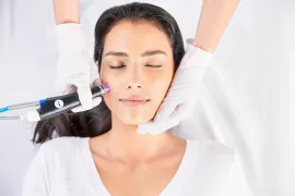 Top Benefits of Microneedling in Fort Lauderdale, FL