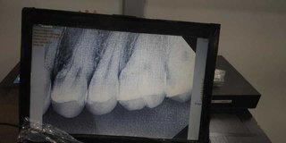 My Actifit Report Card: February 19 2024