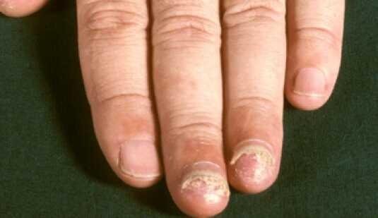 featured