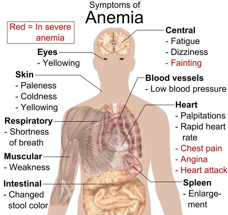 Signs and Symptoms