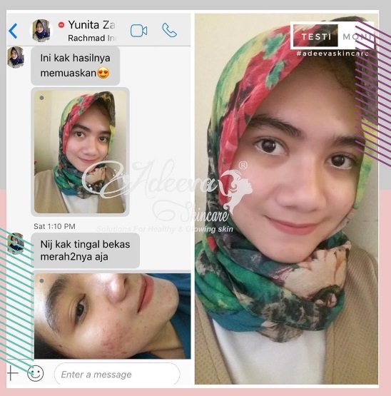 adeev a testimoni asli