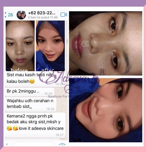 testimoni original adeeva original.