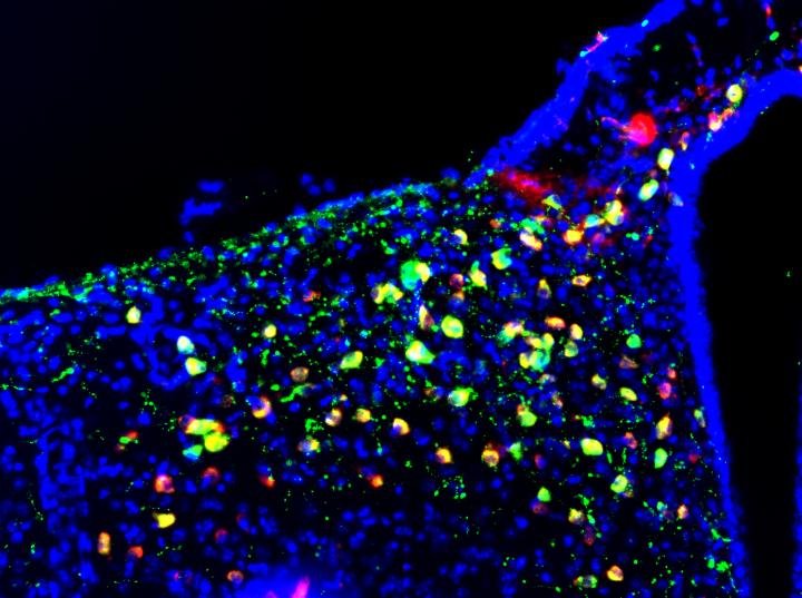 Hypothalamus fluorescent microscopy