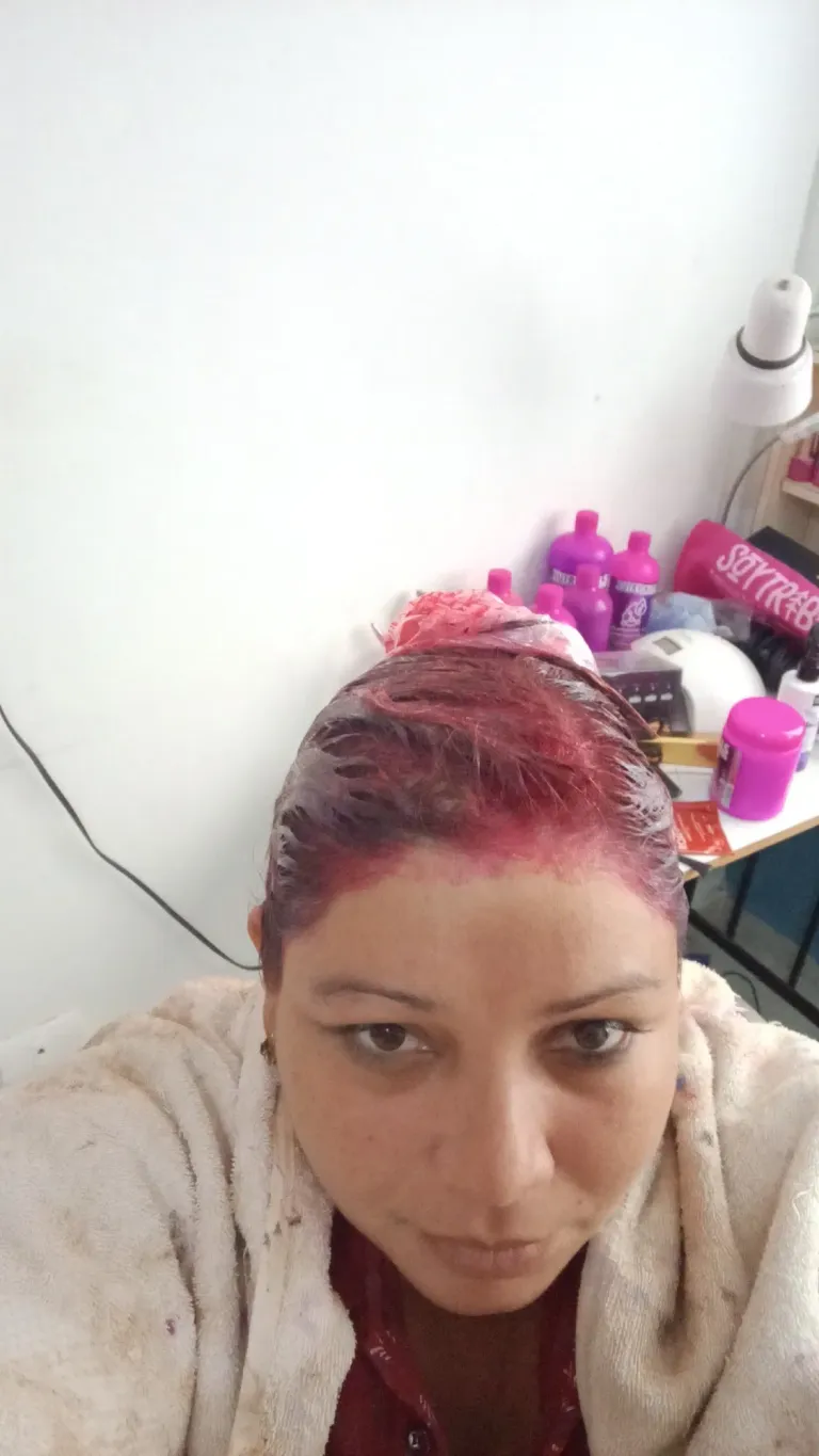 sX3VfBgFlDDWdF8B_1000130248.webp