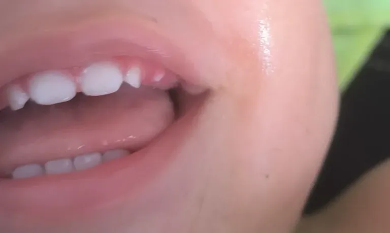 Q3oeIj12THpBYER9_1000045183.webp