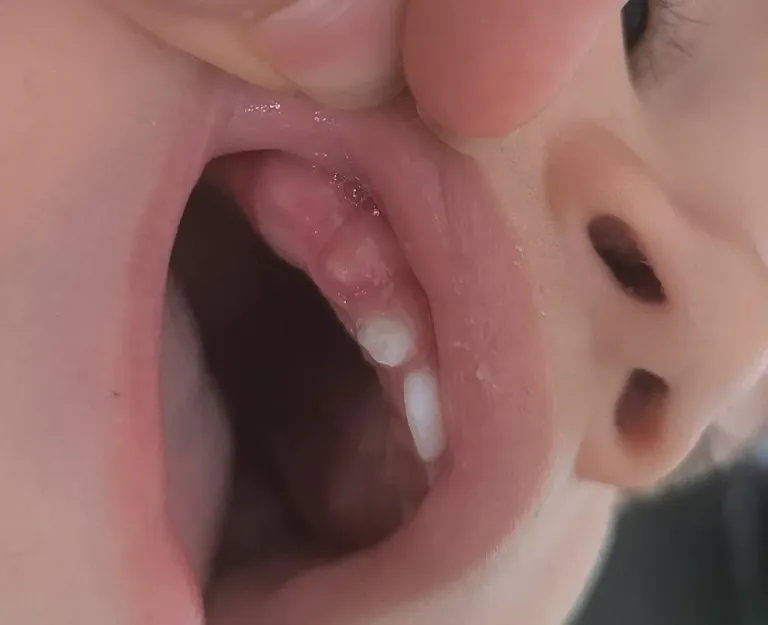 pn7TWa6xzfqexzVi_1000045185.webp