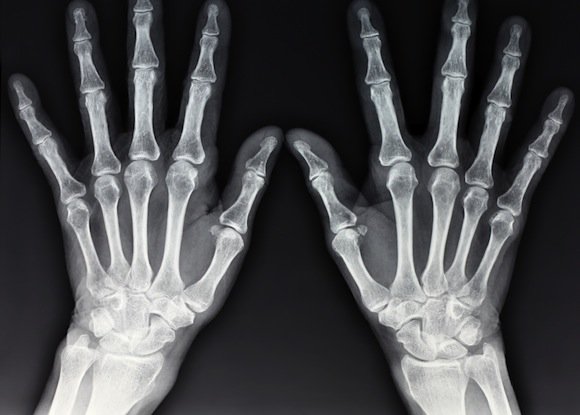 x-ray-hands.jpg