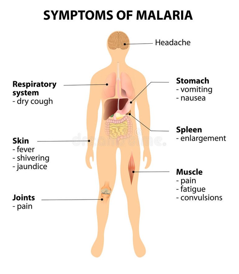 symptoms-malaria-how-to-recognize-signs-disease-organs-silhouette-man-50931264.jpg