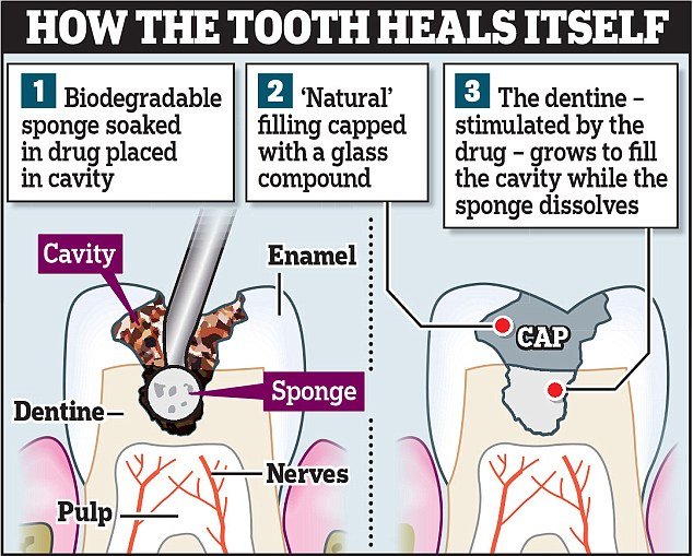 tooth-1.jpg