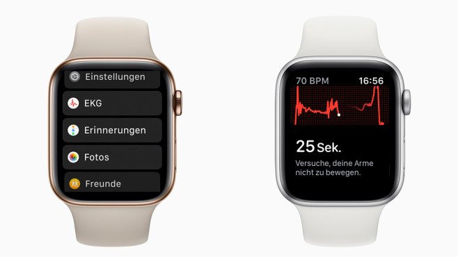 Apple-Watch-EKG-658x370-73a94729cc62b070.jpg