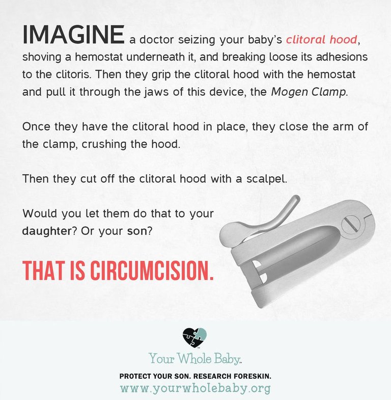 FGM.jpeg