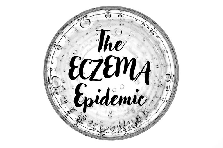 eczema-header.jpg