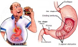 asam-lambung-gerd.jpg