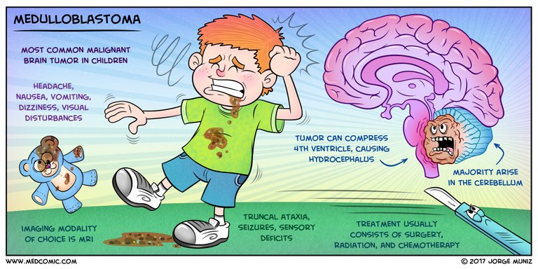 Medulloblastoma.jpg