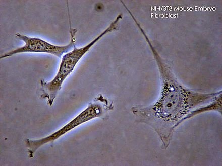 440px-Fibroblast.jpg