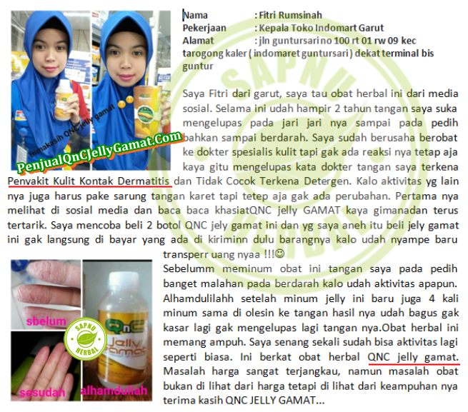 Testimoni QnC Jelly Gamat ~ Eksim atau dermatitis kontak - penyakit kulit - kulit luka - kulit gatal.png