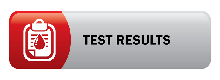 Modafinil drug test