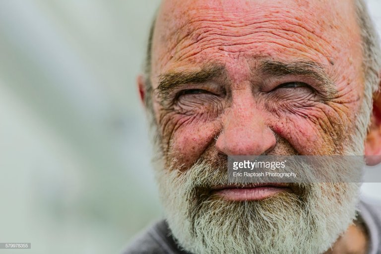 wrinkled face getty images.jpg