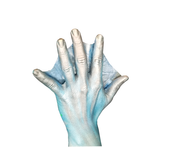 webbed fingers edit.png