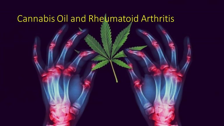 Rheumatoid-Arthritis-.jpg