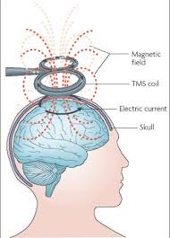 brain magnetic field.jpg