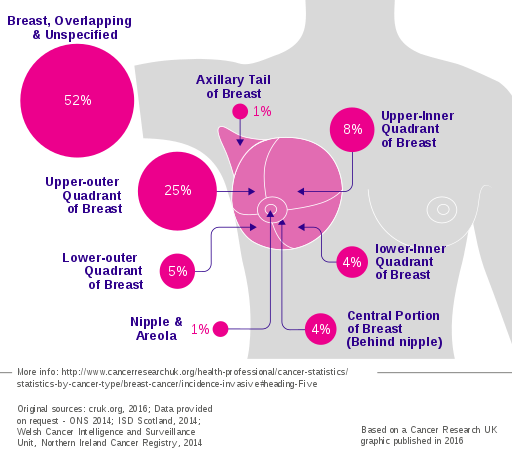 Breast_cancer_incidence_by_anatomical_site_(females).svg.png