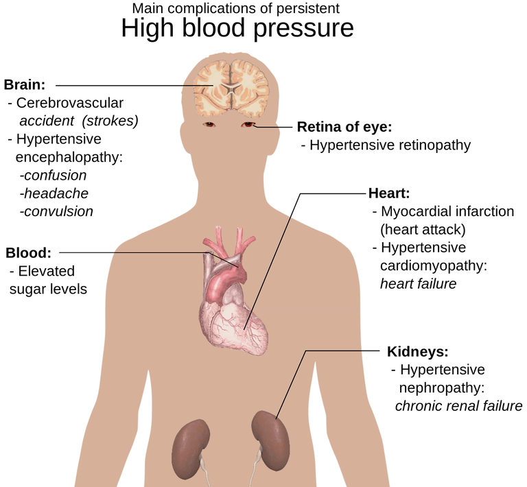 anatomy-of-the-human-body-1279987_1280.png