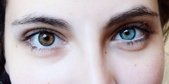 heterocromia-5.jpg