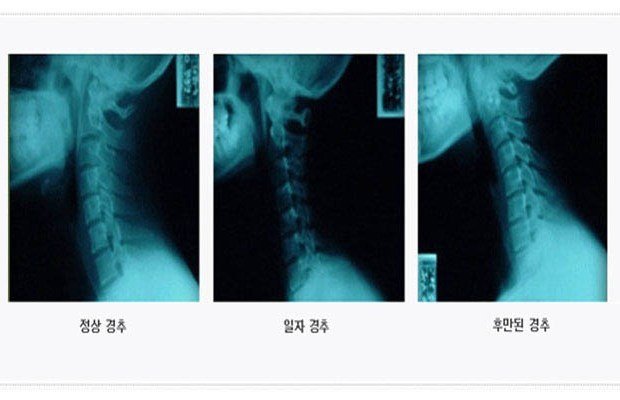 경추.jpg