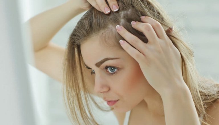 women-hair-loss-female-androgenetic-alopecia-symptoms-1024x585.jpg