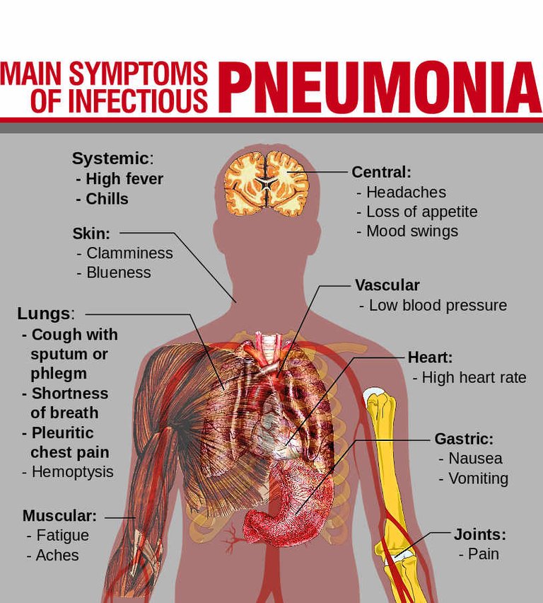 pneumonia1.jpg