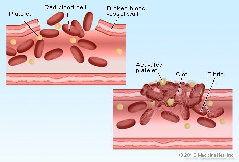 detail_blood_clot.jpg