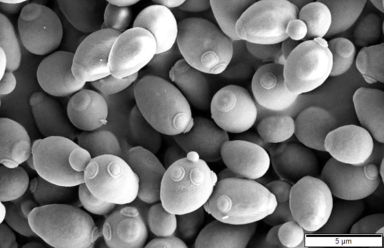 Saccharomyces_cerevisiae_SEM.jpg