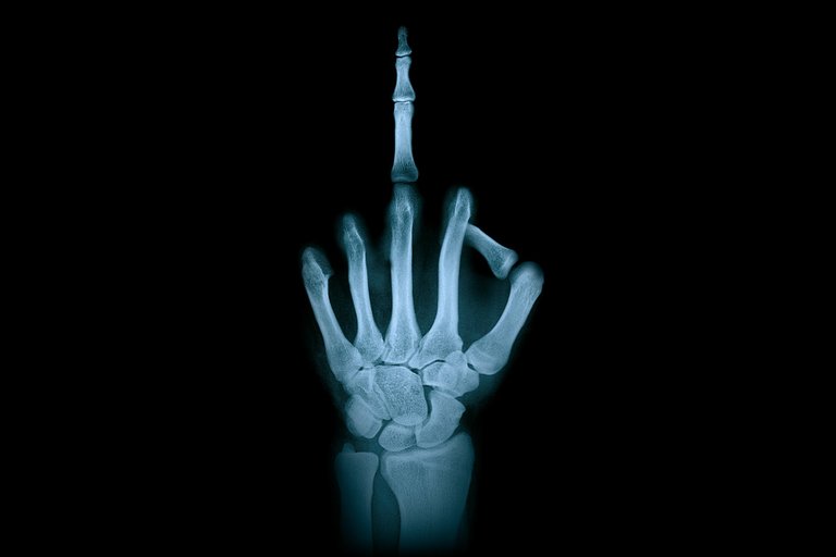 MaxPixel.freegreatpicture.com-Hand-Finger-Gesture-X-ray-Radiation-Middle-Finger-2194167.jpg