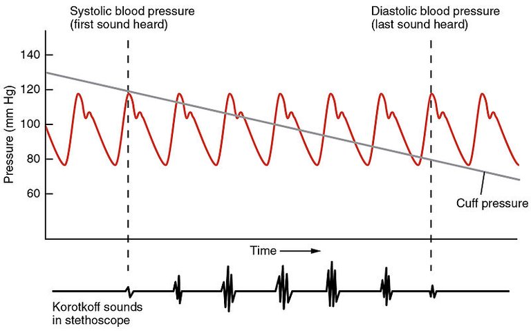 2111_Blood_Pressure_Graph.jpg