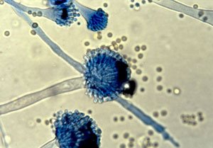 aspergillus9b fumigatus.jpg