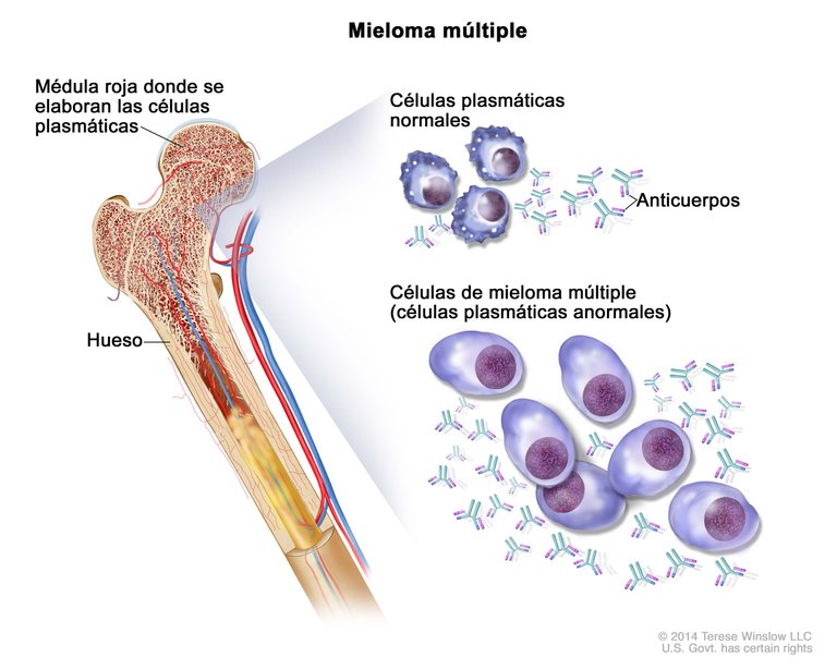 mieloma 3 células plasmáticas.jpg