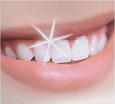 White-Sparkling-Teeth.jpg